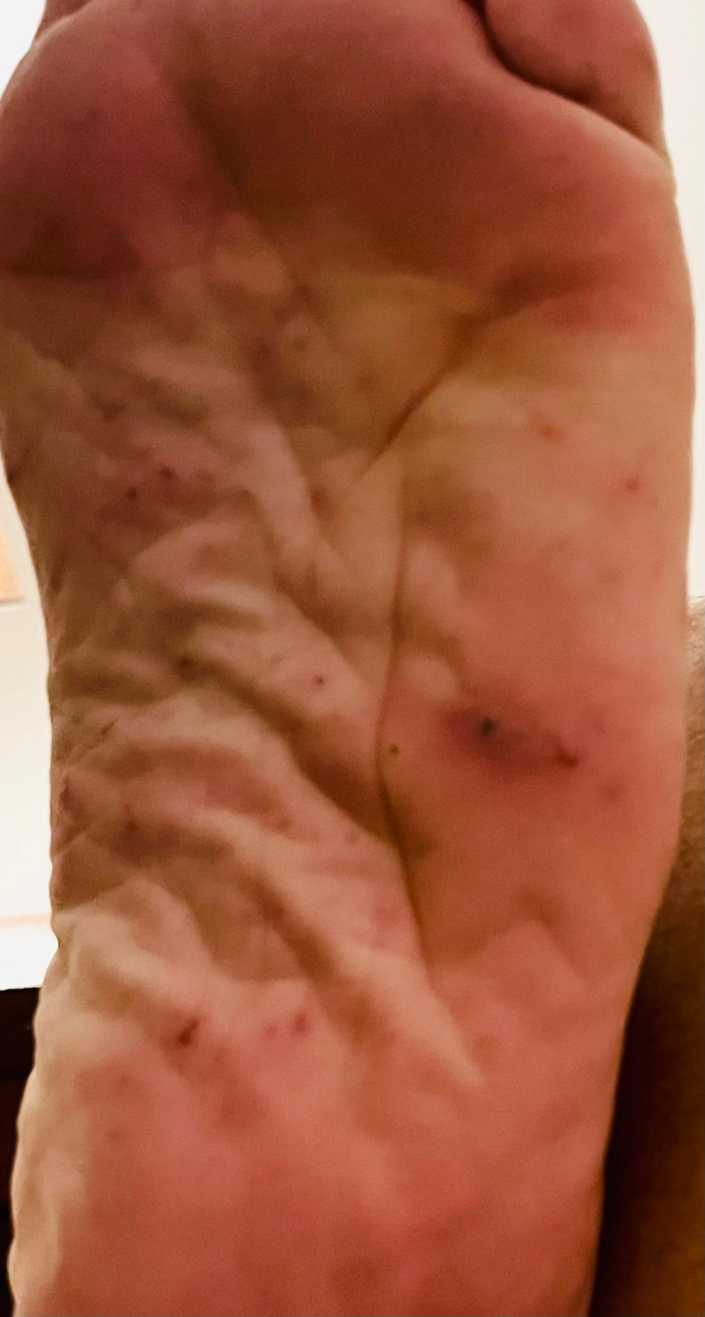 When the System Needs a Scapegoat: Foreignness, Mental Health, and Being Disposable in Today’s UK — Part&nbsp;1